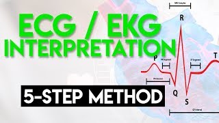 ECG Interpretation Made Easy  ECG EKG Interpretation Part 2 [upl. by Eatnod246]