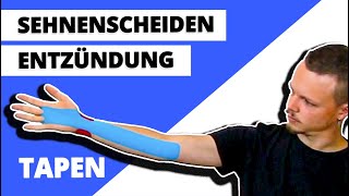 Sehnenscheidenentzündung tapen  Handgelenk tapen  Kinesiologie ANLEITUNG [upl. by Tyre]