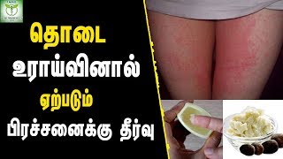 Natural Remedies for Inner Thigh Rashes  Skin care Tips in Tamil  Tamil Health amp Beauty Tips [upl. by Ronnie737]