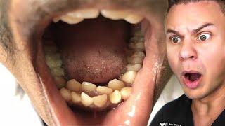 Orthodontist Reacts To The WEIRDEST Teeth On TikTok [upl. by Ennadroj882]