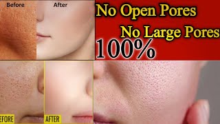 How to minimize poreshow to get rid of large poresGet A Rid Of Open Pores At Home [upl. by Coshow]