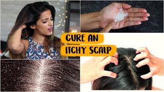 6 WINTER Haircare Hacks To Get Rid Of An Itchy Scalp Naturally At Home Tips amp Tricks [upl. by Nnep]