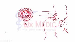 8 RM19 1V CIRUG A GENERAL TUMOR DE COLON Y RECTI [upl. by Brigham]