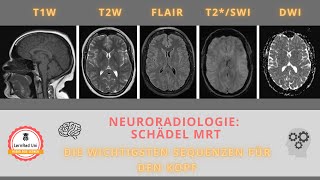 MRT Kopf Die wichtigsten Sequenzen [upl. by Sherman]