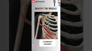 Identify the Muscle of upper limb quiz upperlimbanatomy anatomy humananatomy [upl. by Nibaj105]