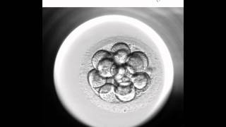 Embryoscope 2  Nuevo método de cultivo y selección embrionaria [upl. by Hitchcock401]