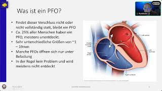 Risikofaktor PFO  Was bedeutet das fürs Tauchen [upl. by Nnylodnewg]