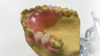 How To Make A Fiber Flex™ Partial  The Entire Process  Dental Lab Learning [upl. by Kartis]