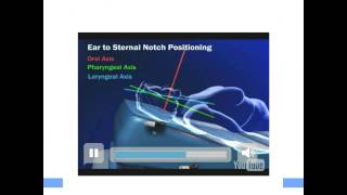 Patient positioning ear sternal notch 2013 [upl. by Chapell]