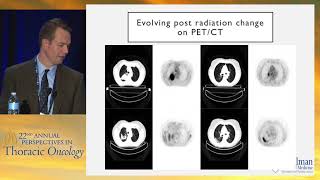 Going beyond positron emission tomography PET New imaging approaches [upl. by Yelsha]