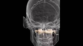 The Atlas Bone The first Vertebra Of Your Spine [upl. by Sirrom]