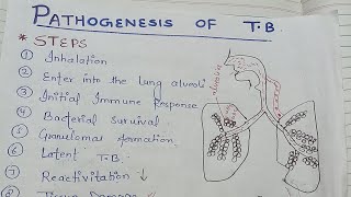 pathogenesis of tuberculosis NGMedicals [upl. by Norah608]