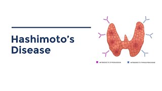 Hashimotos Disease Lecture [upl. by Margetts]