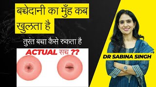 बच्चेदानी का मुँह खुलने के लक्षण जल्दी Pregnant होने का तरीका [upl. by Lorena]