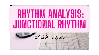 EKG Rhythm Analysis Junctional rhythm [upl. by Devaney]