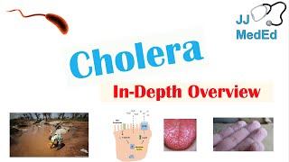 Cholera Vibrio Cholerae Pathophysiology Risk Factors Symptoms Diagnosis and Treatment [upl. by Towill]