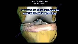 Tests For Examination Of The Knee Everything You Need To Know Dr Nabil Ebraheim [upl. by Yaned960]