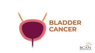 What is bladder cancer [upl. by Nali]