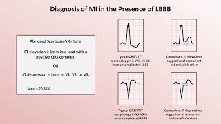 Intro to EKG Interpretation  Myocardial Infarctions Part 2 of 2 [upl. by Elsilrac]