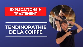 Nouvelles approches de rééducation pour une TENDINOPATHIE de la COIFFE  Explications amp traitement [upl. by Meehan]