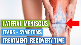 LATERAL Meniscus Tears Symptoms Treatment Surgery vs Exercise amp Recovery Time [upl. by Heidi]