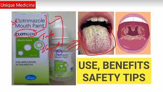 Clotigem Mouth Paint for Fungal Infection of Mouth । Clotrimazole Mouth Paint Uses amp Benefits [upl. by Milly]