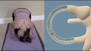 Half Somersault Maneuver to Treat BPPV Vertigo [upl. by Brendis583]