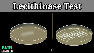 Lecithinase Test  Naglers Reaction  Clostridium Testing Method  Test For Clostridium Perfirenges [upl. by Herman]