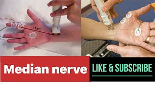 MEDIAN NERVE NERVE CONDUCTION STUDY  NCS  NCV emg ncs ncv neuroscience [upl. by Oht331]