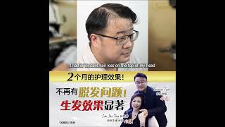 【真实见证】两个月的护理后，头发长出来了！生发效果显著！ 8TV新闻主播林思婷的丈夫Terence解决严重的脱发了！ Jonsson Protein 美国脱发救星 [upl. by Germin419]