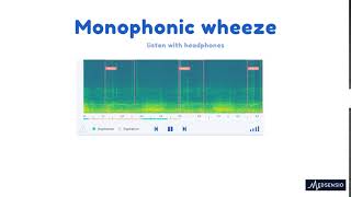 Lung sounds  monophonic wheeze [upl. by Yznyl]