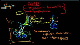 Pathophysiology of COPD [upl. by Ahsinac872]