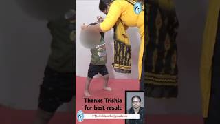 Cerebral Palsy kid with Hyperextension Knee started walking with straight knee cerebralpalsy [upl. by Ikcaj]