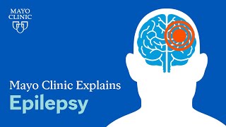 What is epilepsy A Mayo Clinic expert explains [upl. by Armanda645]