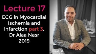 ECG from A to Z 017Alaa nasr2019 Myocardial ischemia part 3 [upl. by Alhak]