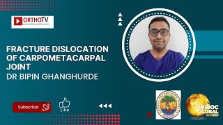 Fracture dislocation of Carpometacarpal joint  Dr Bipin Ghanghurde [upl. by Sinnelg]