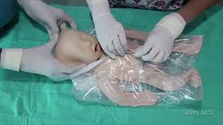 Thermal care of very preterm infants using plastic cling [upl. by Marys516]