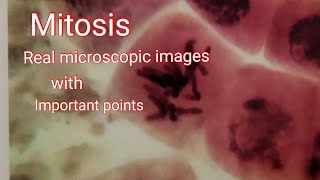 Mitosis  Real microscope image cell division with important points [upl. by Enirehtak]