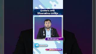 Crohns Disease vs Ulcerative Colitis  Quick Bites Internal Medicine Gastroenterology [upl. by Lallage]