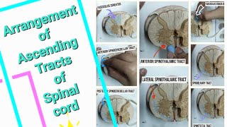 Arrangement of Ascending Tracts of Spinal card [upl. by Kind]