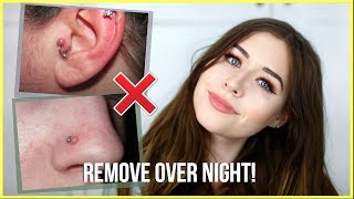 How To Get Rid Of Piercing Bumps OVERNIGHT [upl. by Airitak495]