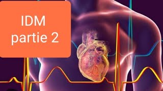 Cours Infarctus de myocarde 《PARTIE2》 [upl. by Aek141]