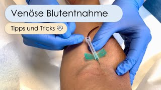 Blutentnahme Mit 19 Tipps amp Tricks zum Erfolg [upl. by Nuhsal]