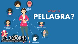 What is pellagra What is PREpellagra [upl. by Liagabba]