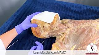 Muscle Anatomy Master Class Sternocleidomastoid Cadaver [upl. by Sherourd]