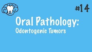 Oral Pathology  Odontogenic Tumors  INBDE ADAT [upl. by Raychel]