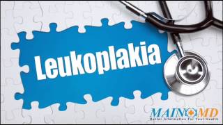 Leukoplakia ¦ Treatment and Symptoms [upl. by Stuckey]