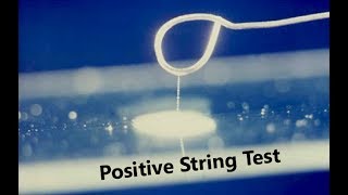 String test positive Vibrio cholerae [upl. by Fannie]