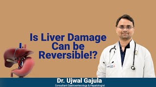 Chronic Liver Disease be cured  Liver Damages can be Reversible  Dr Ujwal Gastroenterologist [upl. by Lunneta257]