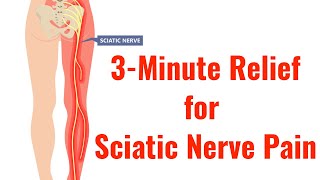 3 of the Best Exercises for Relief of Sciatic Nerve Pain With FREE Exercise Sheet [upl. by Bj]